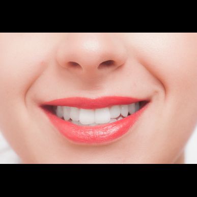 痛くないセルフホワイトニング　東久留米