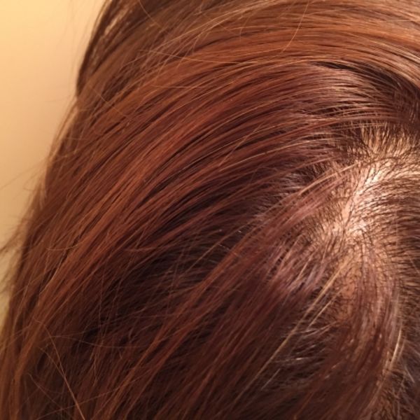 増毛のご相談、カウセリング無料で行っております！！【結んで増やす増毛】