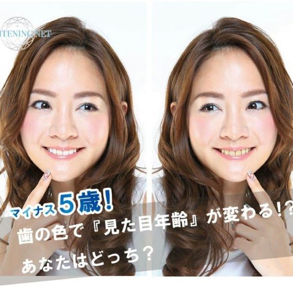 新規限定ホワイトニング初回価格￥1３８８！激安破壊価格でお試しください